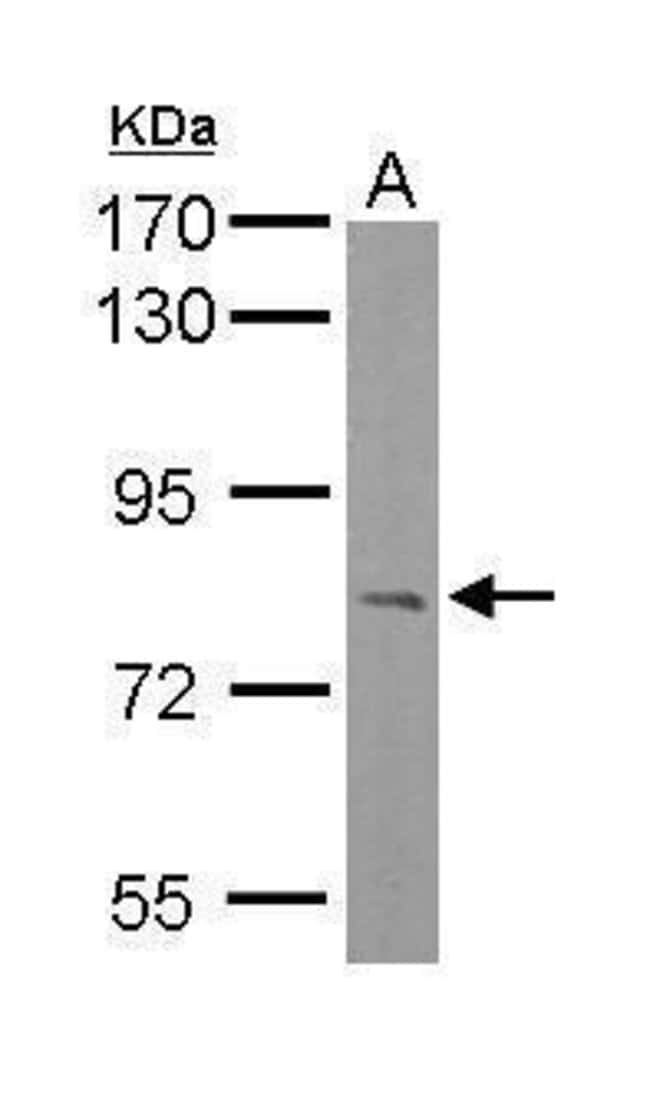 Anti-RC74