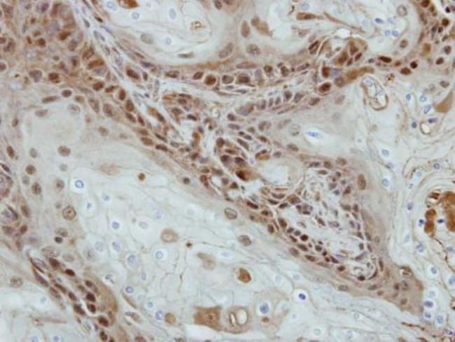 Anti-SOHLH2