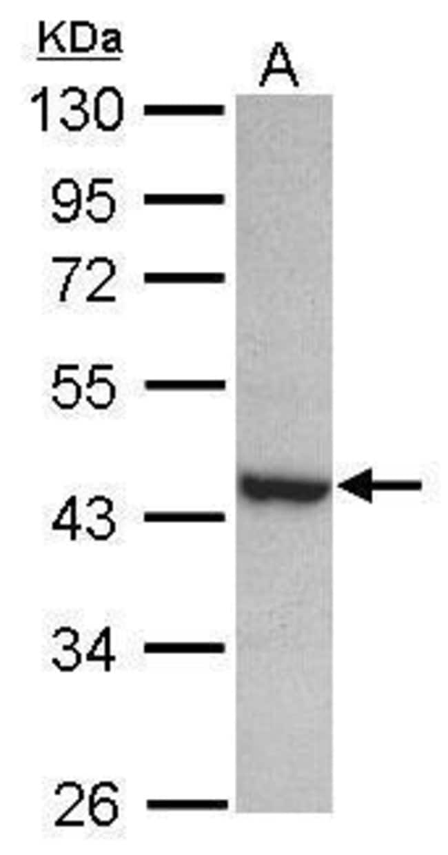 ANTI-PAK1 INTERACTING PROTEIN 1