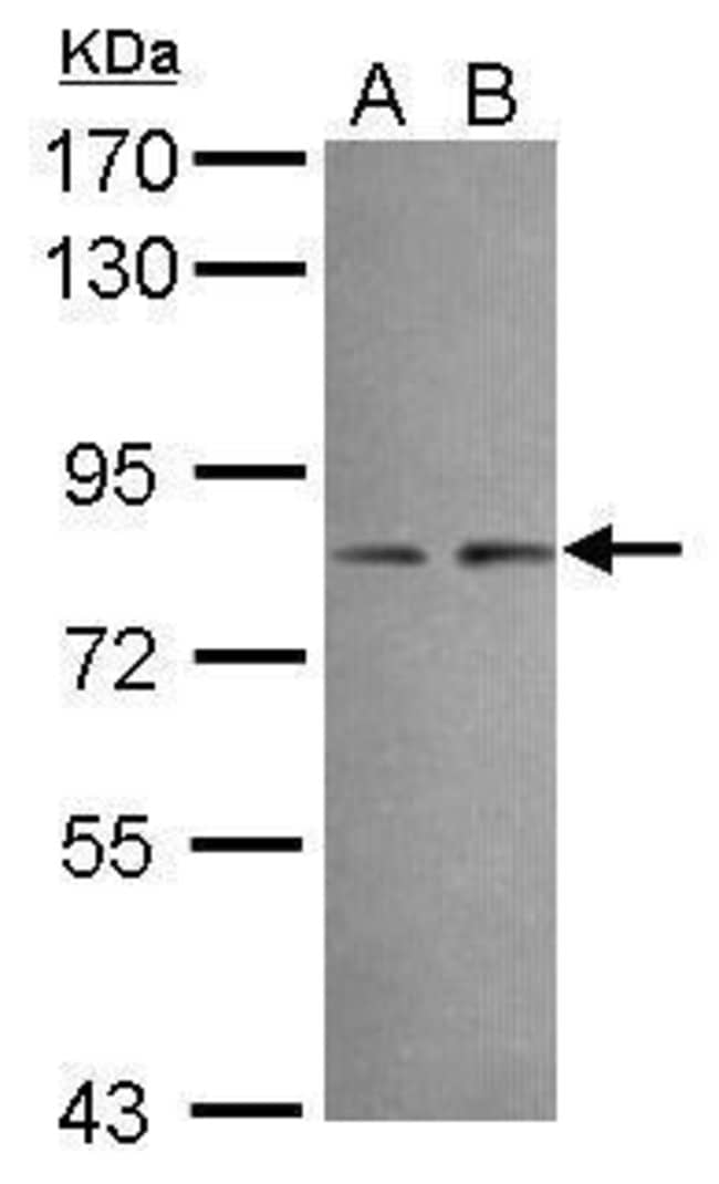 Anti-DIP13B