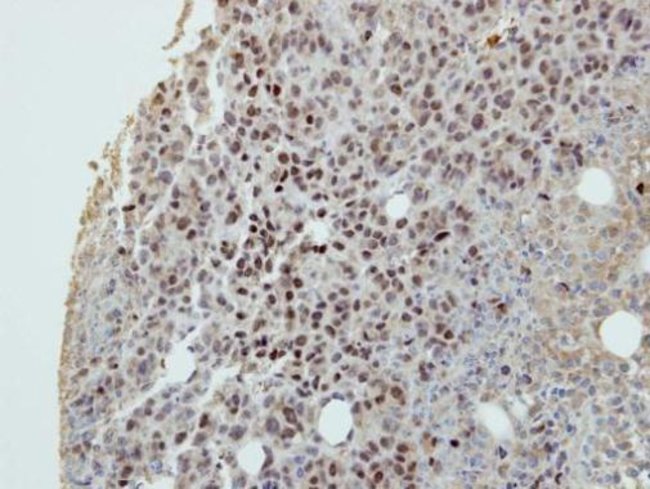 Anti-DIP13B