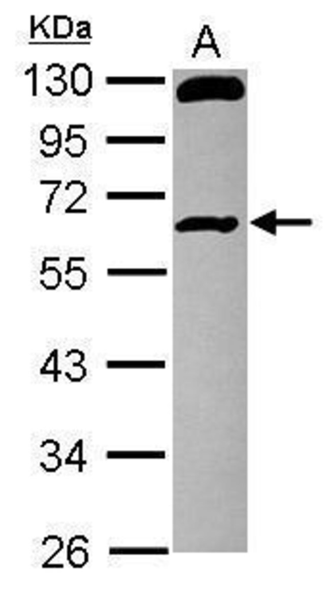 Anti-RCBTB1