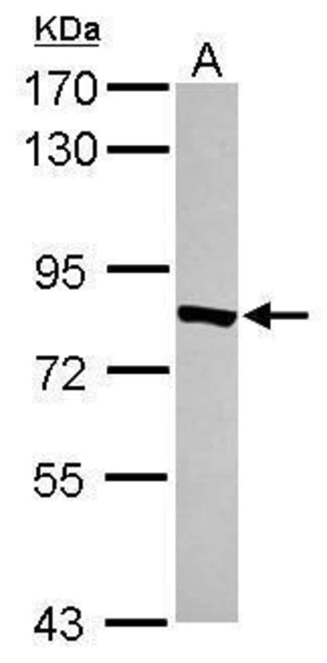Anti-TYW1
