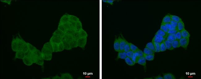 Anti-EIF4EBP1