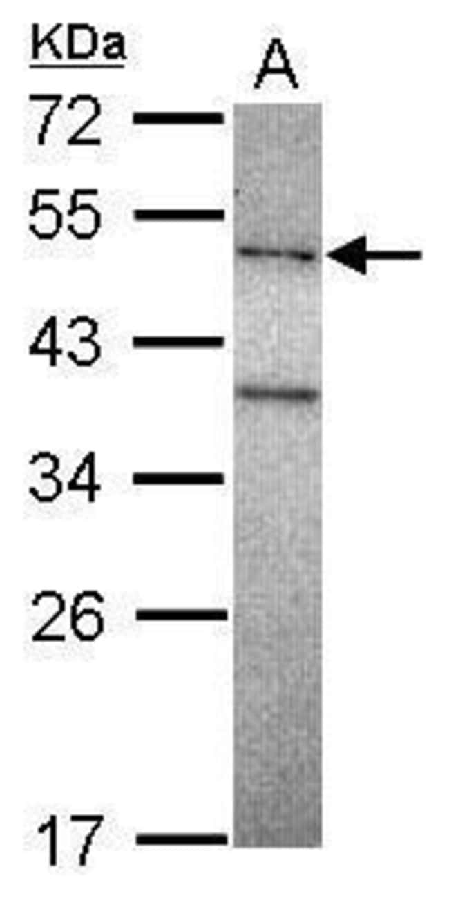 Anti-DNA polymerase mu