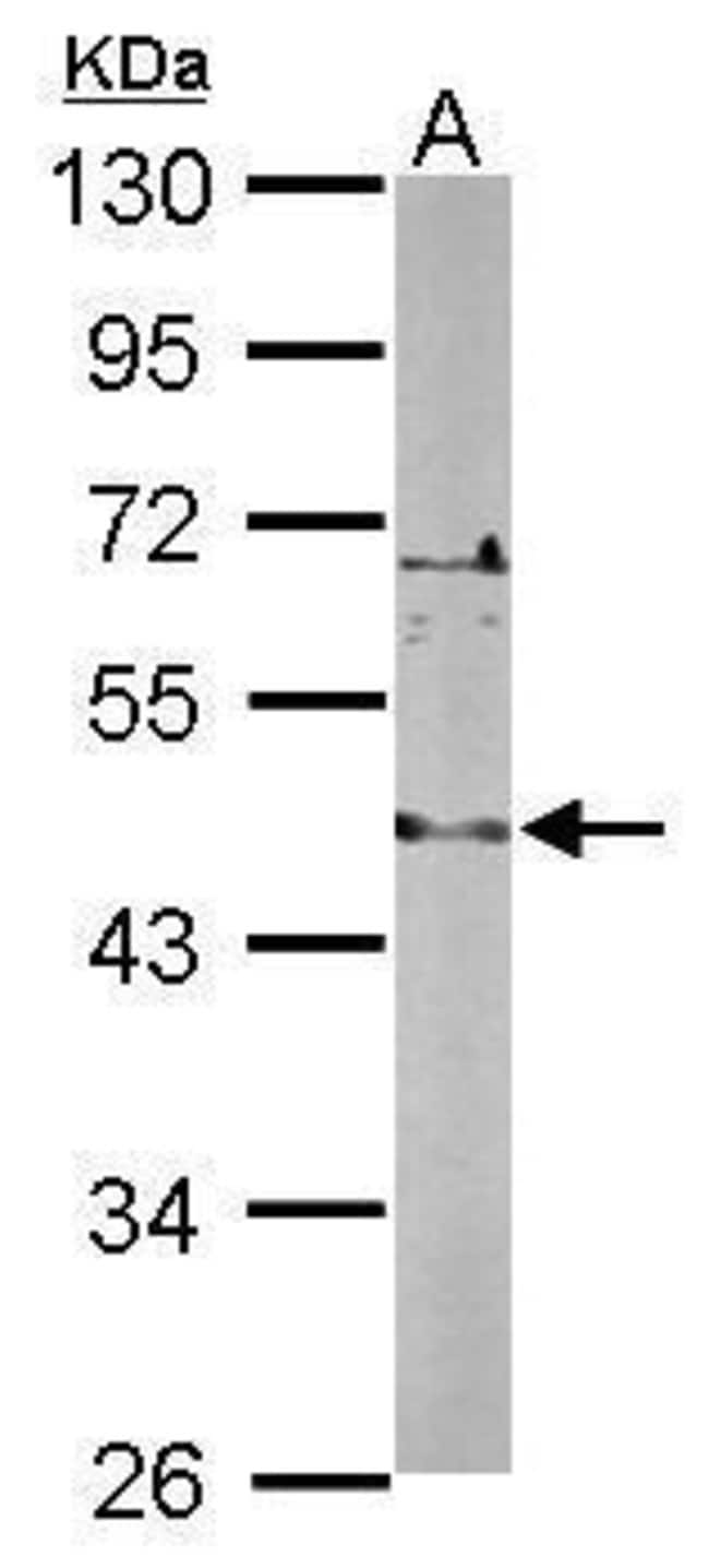 Anti-LDB2