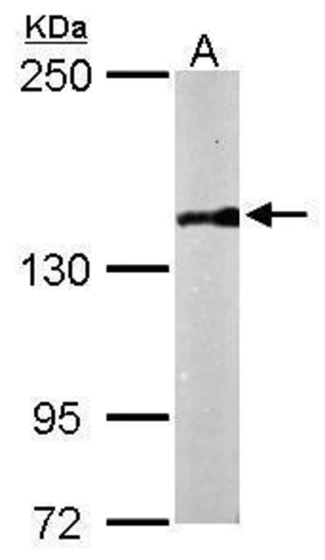 Anti-PDS5B