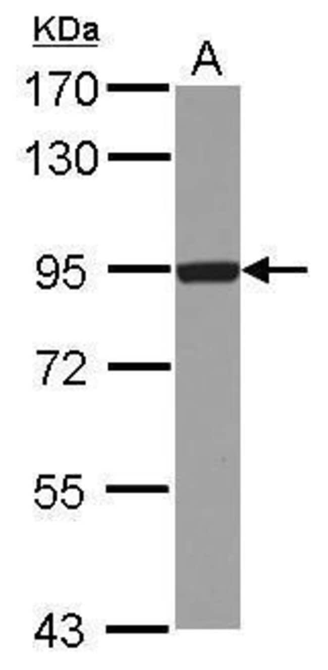 Anti-DTX3L