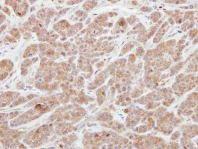 Anti-Centaurin gamma 2