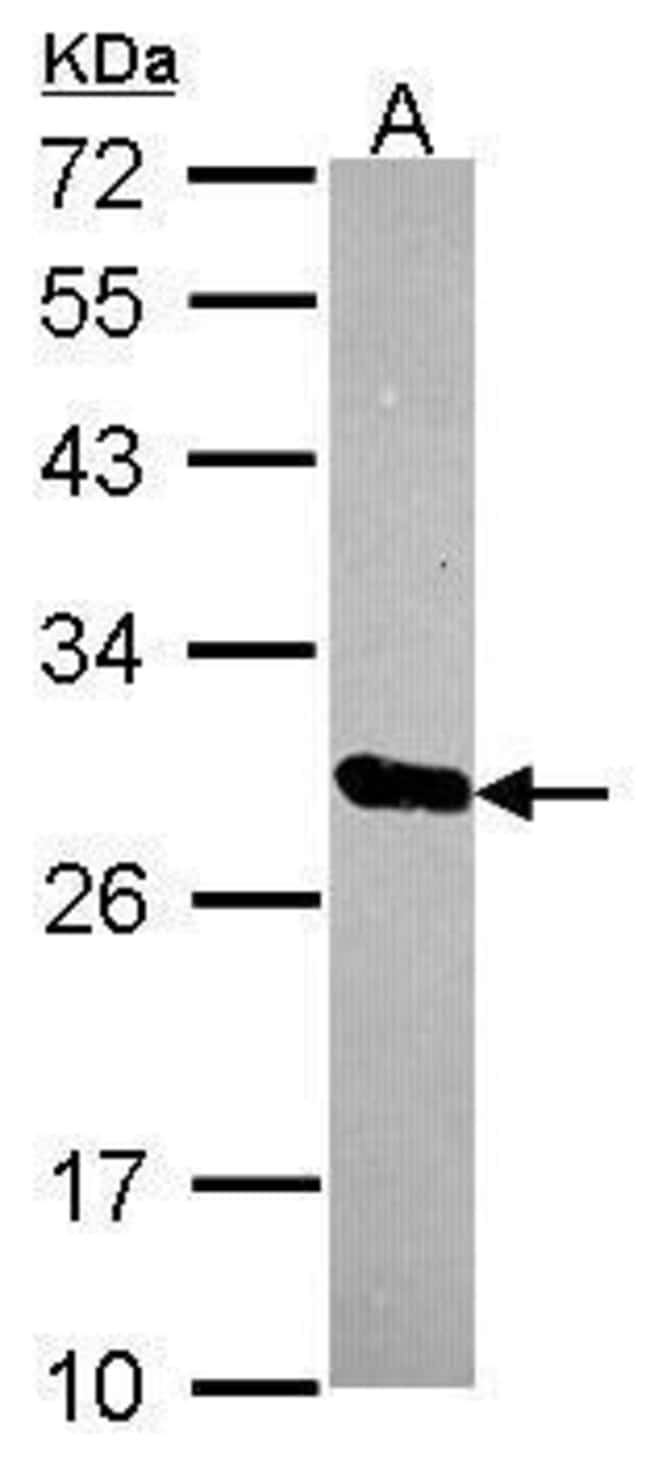 Anti-HscB