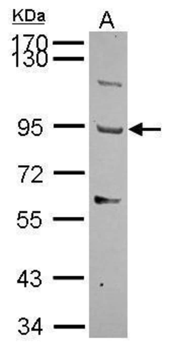 Anti-TMTSP