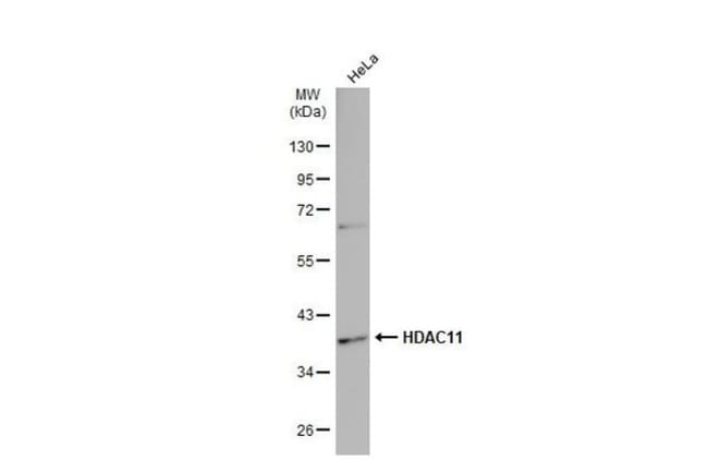 Anti-HDAC11