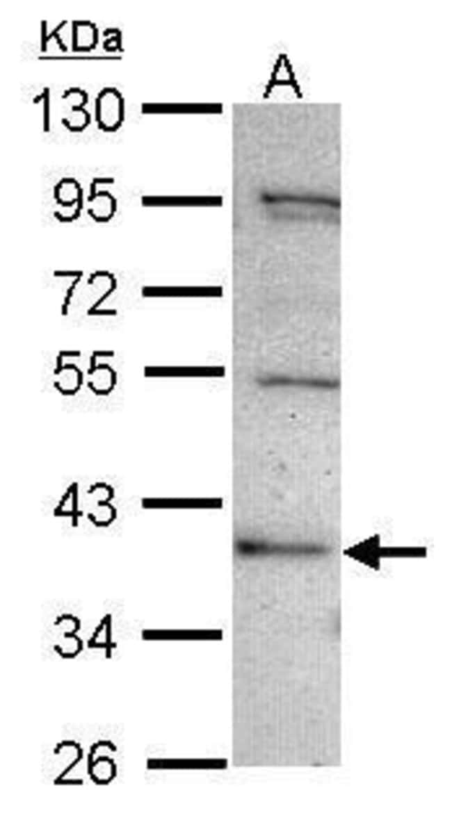 Anti-C2CD2