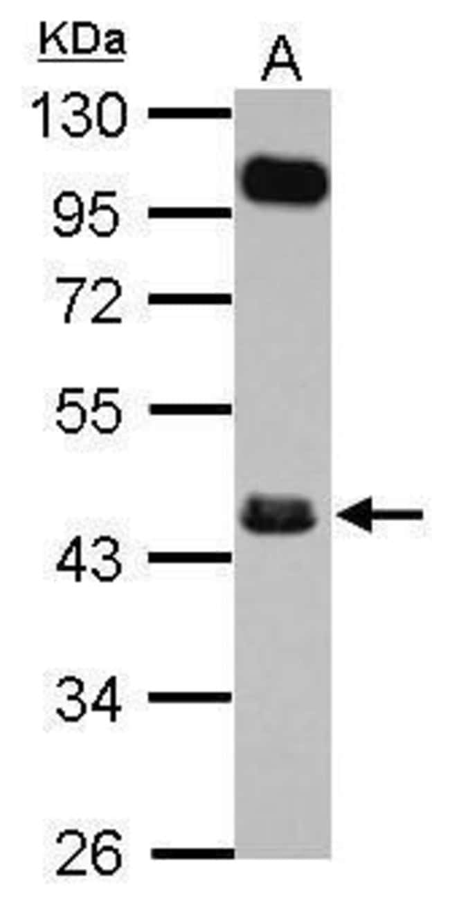 Anti-FCRLM1