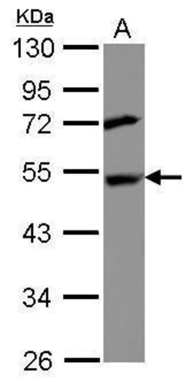 Anti-DEPDC6