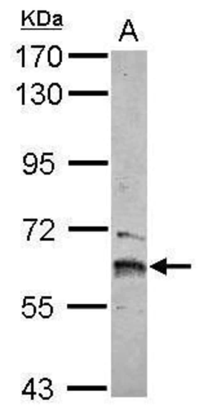 Anti-ZNF83