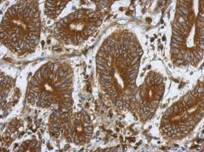 Anti-HIF Prolyl Hydroxylase 4