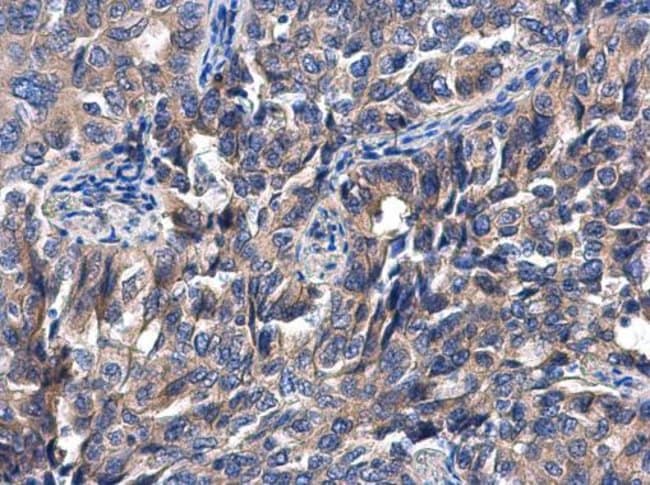 Anti-HIF Prolyl Hydroxylase 4