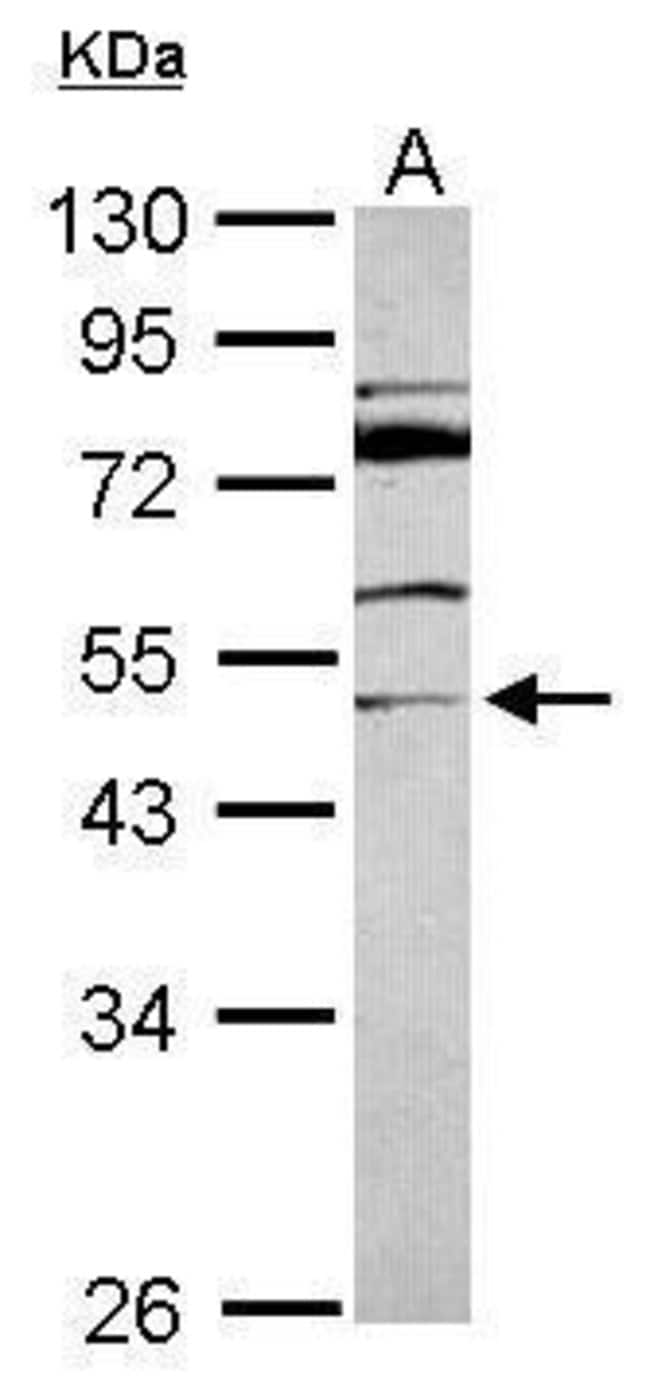 Anti-MDS028
