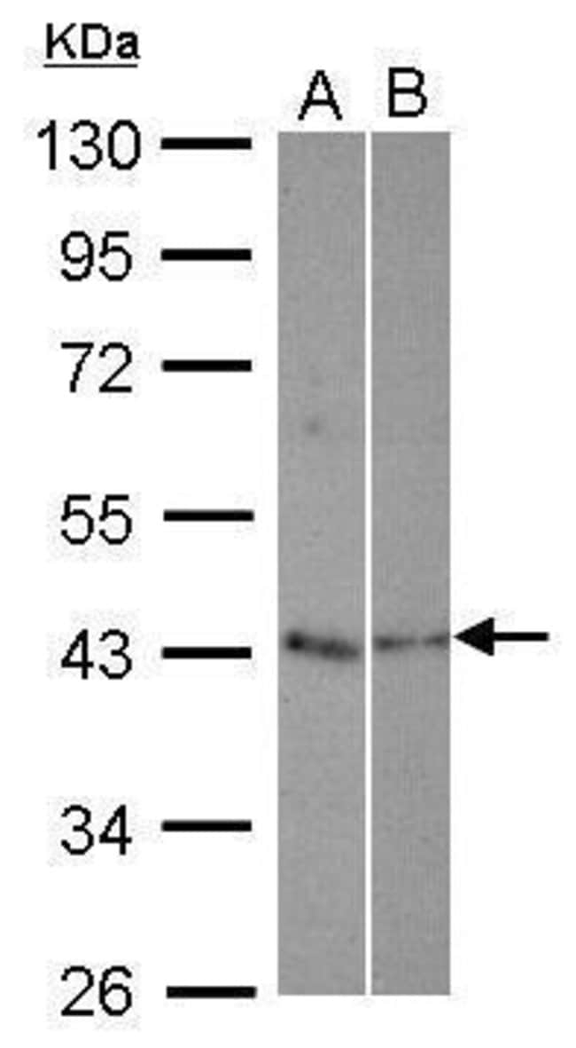 Anti-TEX13A