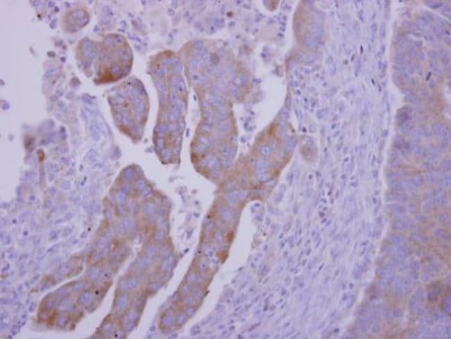 Anti-RNF23
