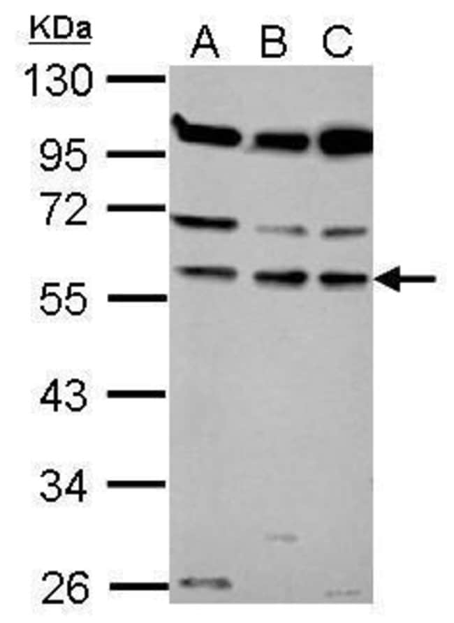 Anti-Coronin 1B