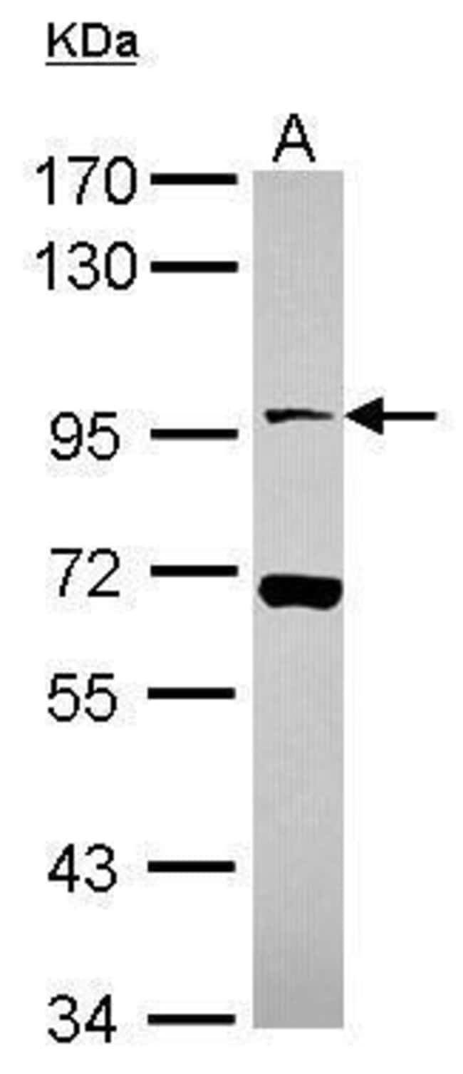 Anti-Neuroligin 4 X-Linked