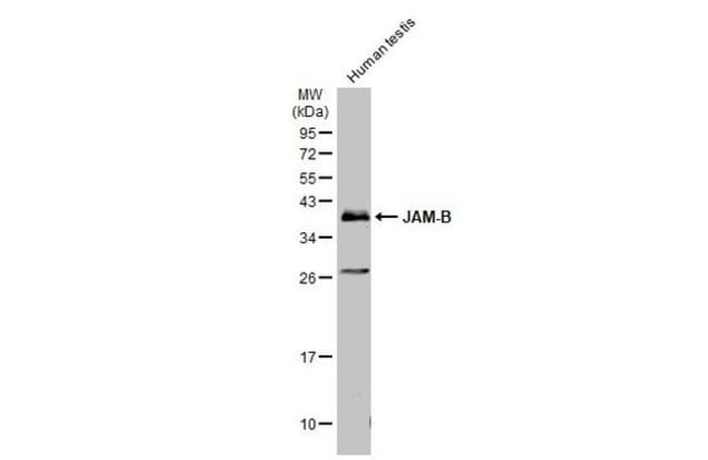 Anti-JAM-B