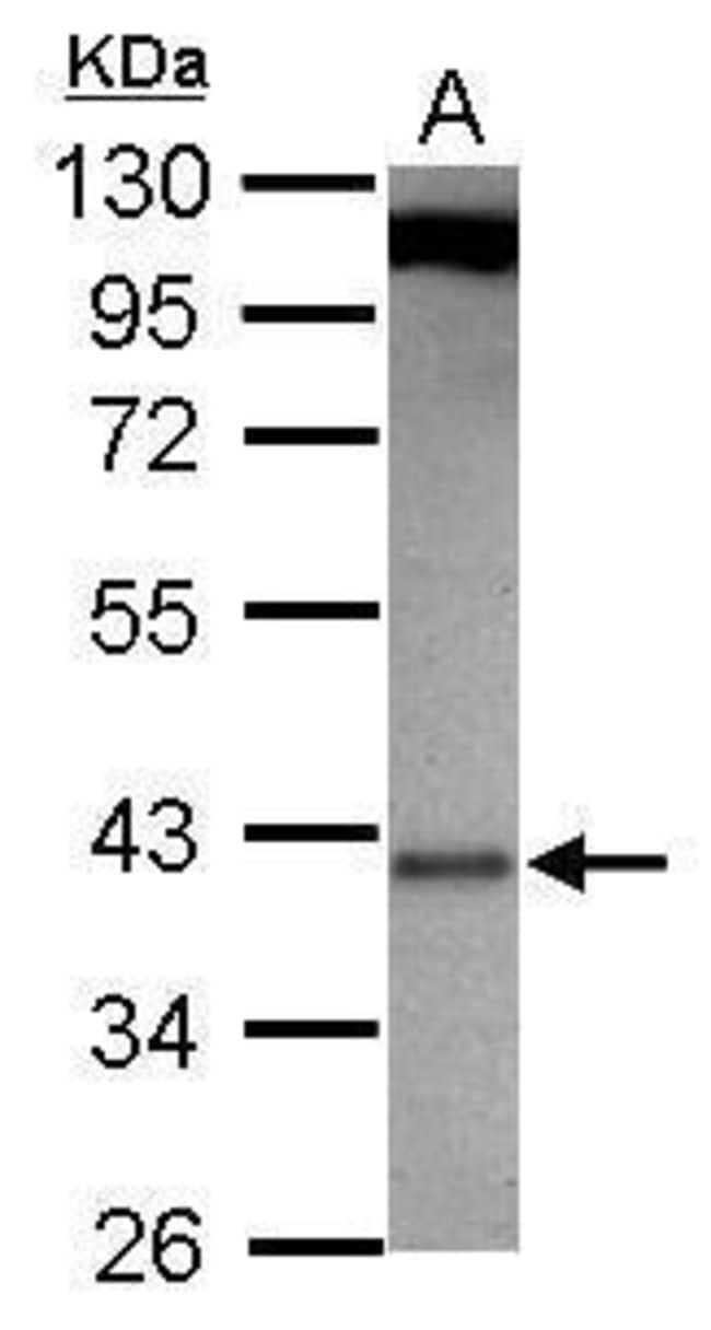 ANTI-G PROTEIN BETA SUBUNIT LIKE