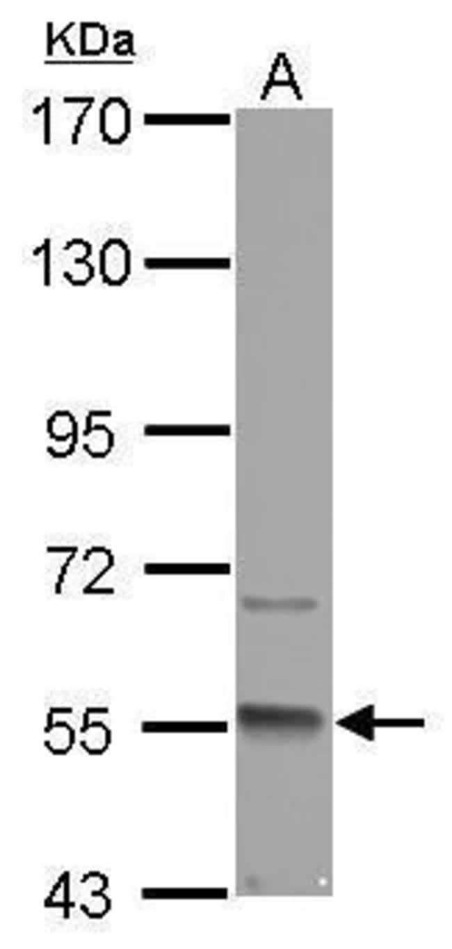 Anti-GMCL1