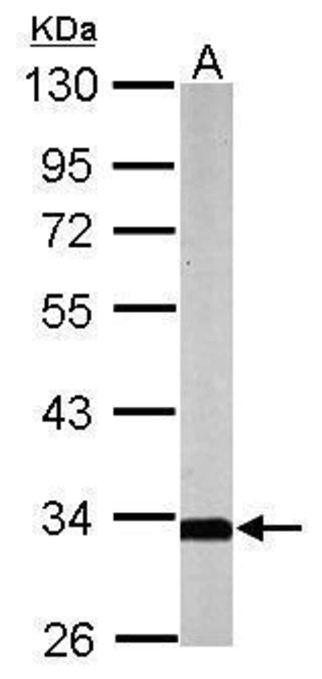 Anti-SLC25A22