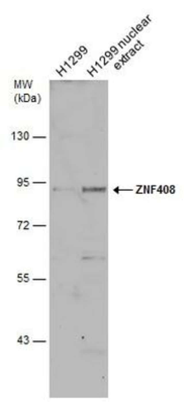 Anti-ZNF408