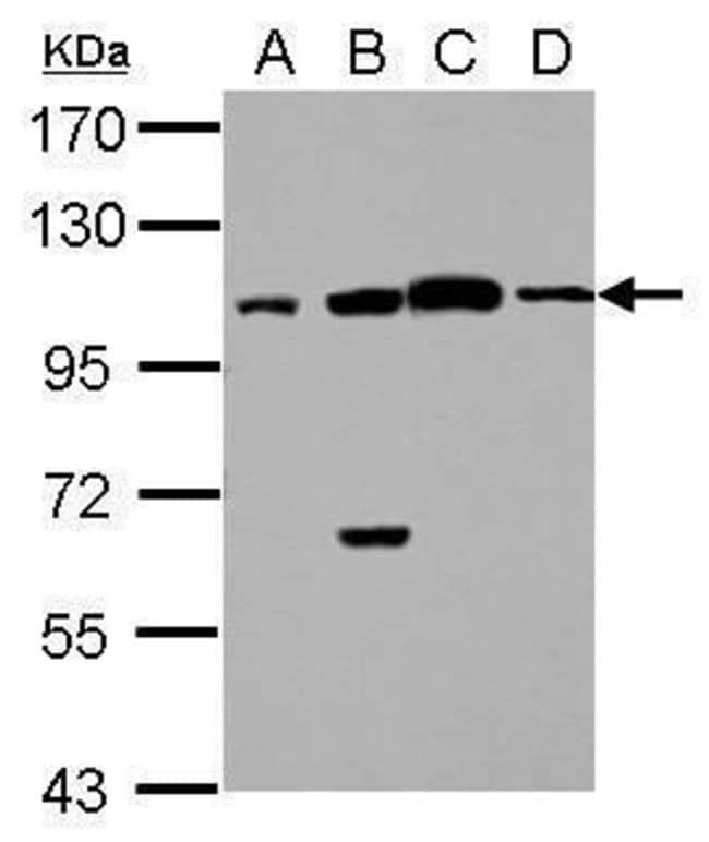Anti-C17orf70