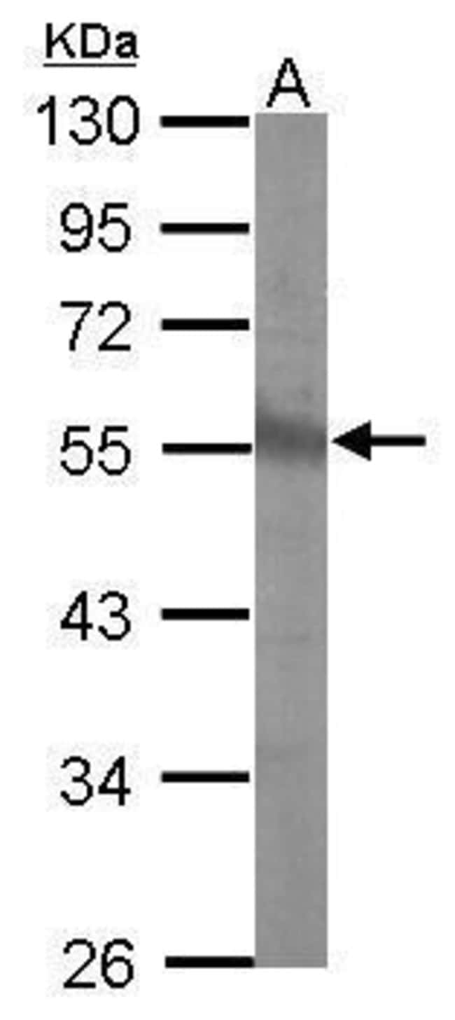 Anti-CHST9