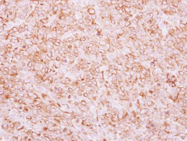 Anti-TEM8