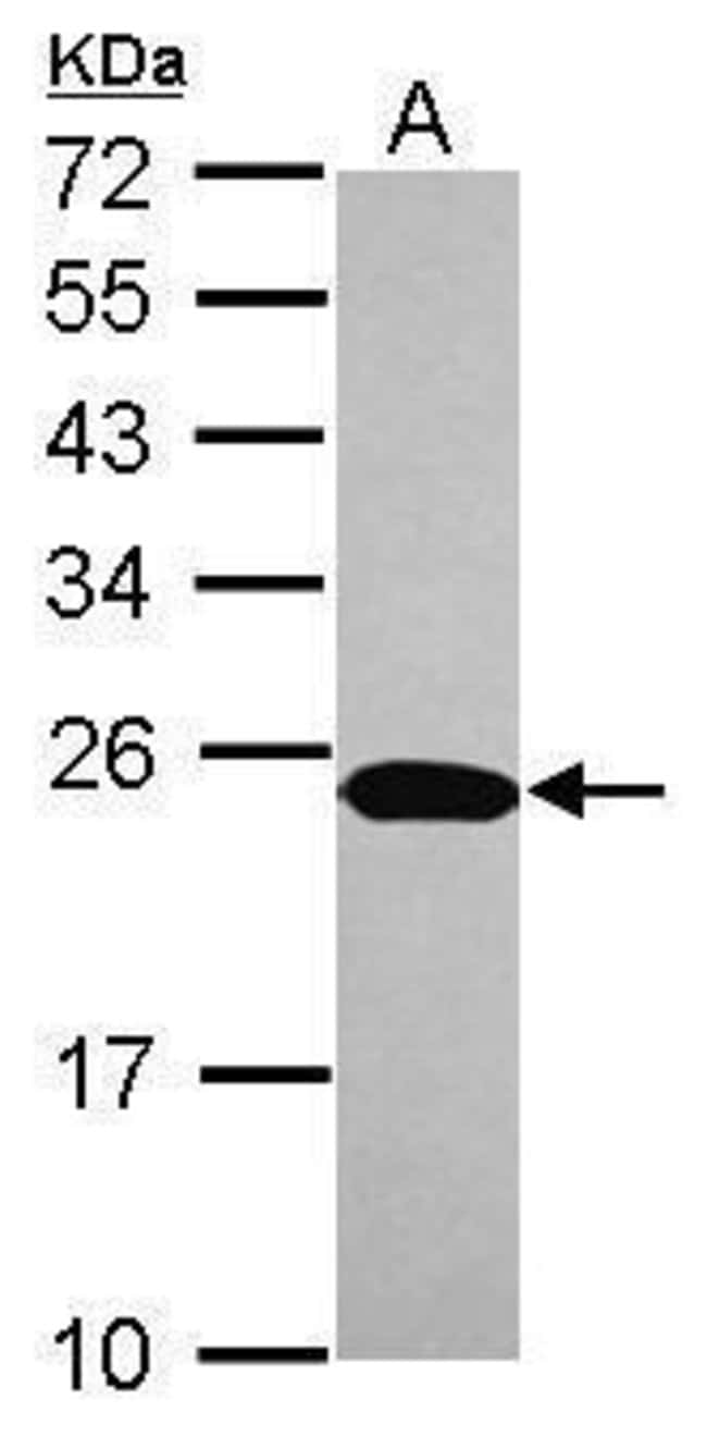 Anti-C1orf57