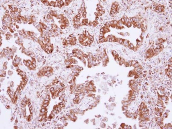 Anti-CML66