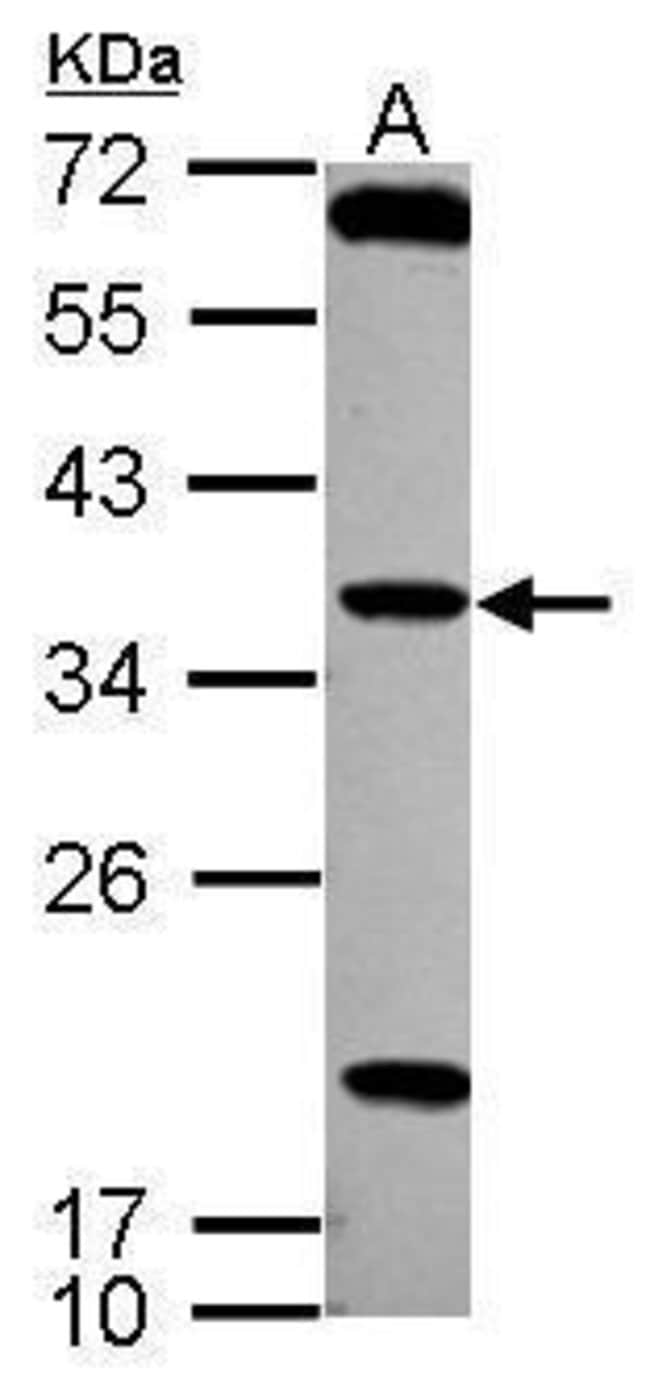 Anti-TSSK4