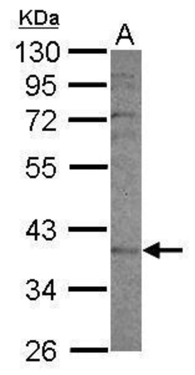 Anti-CYP2F1
