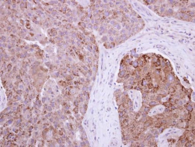 Anti-RAB11FIP1