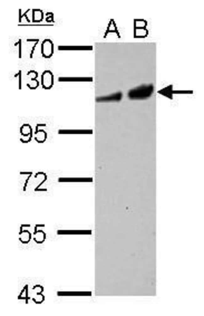 Anti-Adenylate cyclase 2