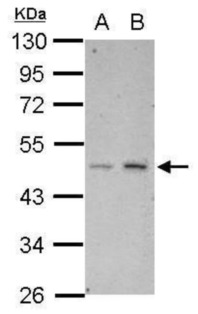 Anti-HTRA3