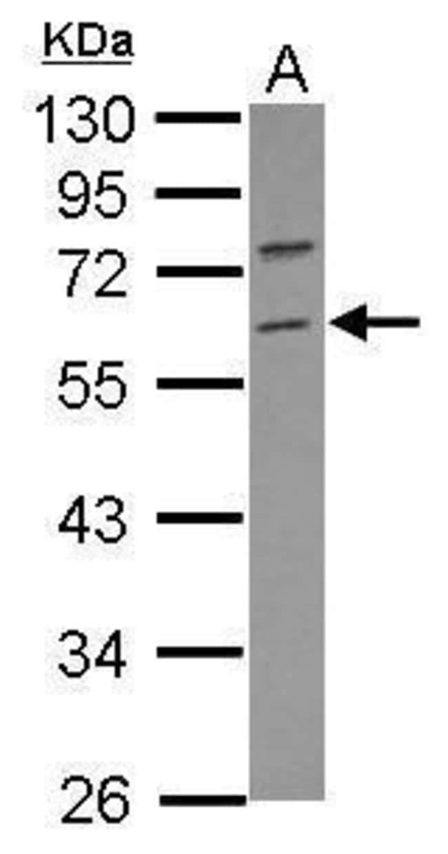 Anti-RNF36