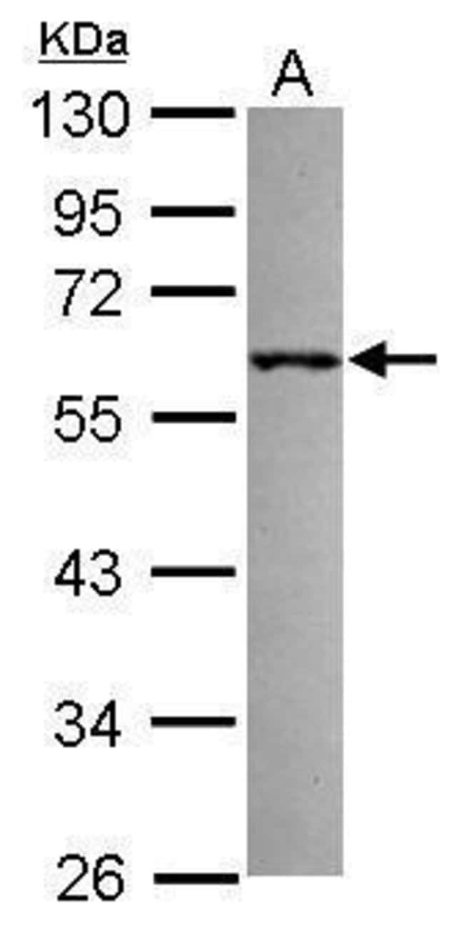 Anti-RNF36