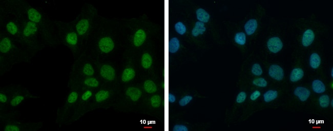 Anti-ZNF596