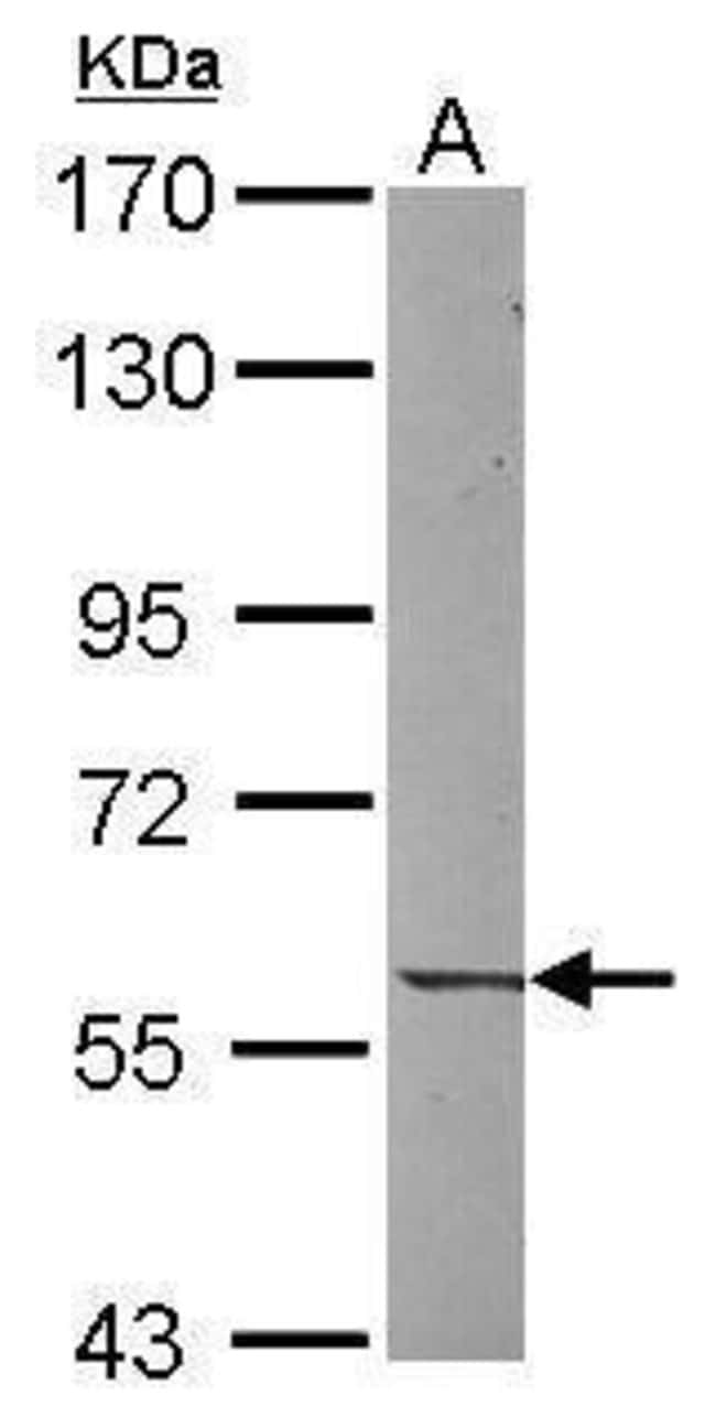 Anti-UNC5CL