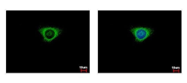 ANTI-GLUTATHIONE S-TRANSFERASE KAPPA 1