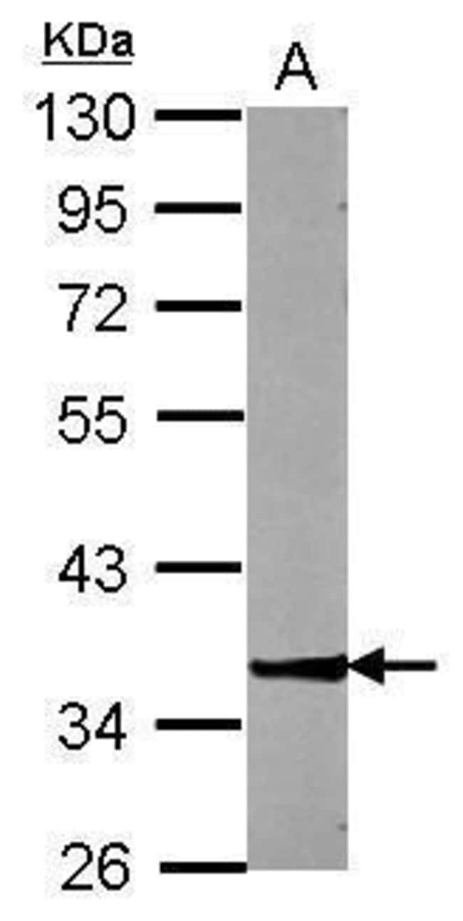 Anti-ZNF396