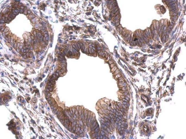 Anti-Periplakin