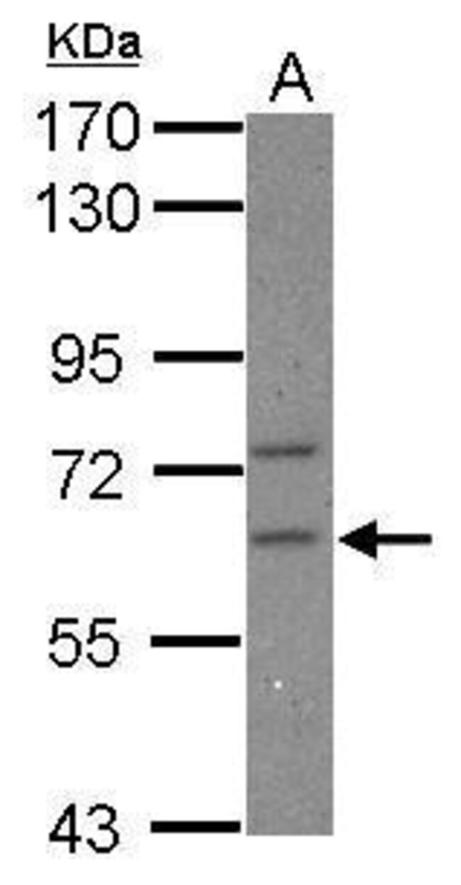 Anti-CPEB2